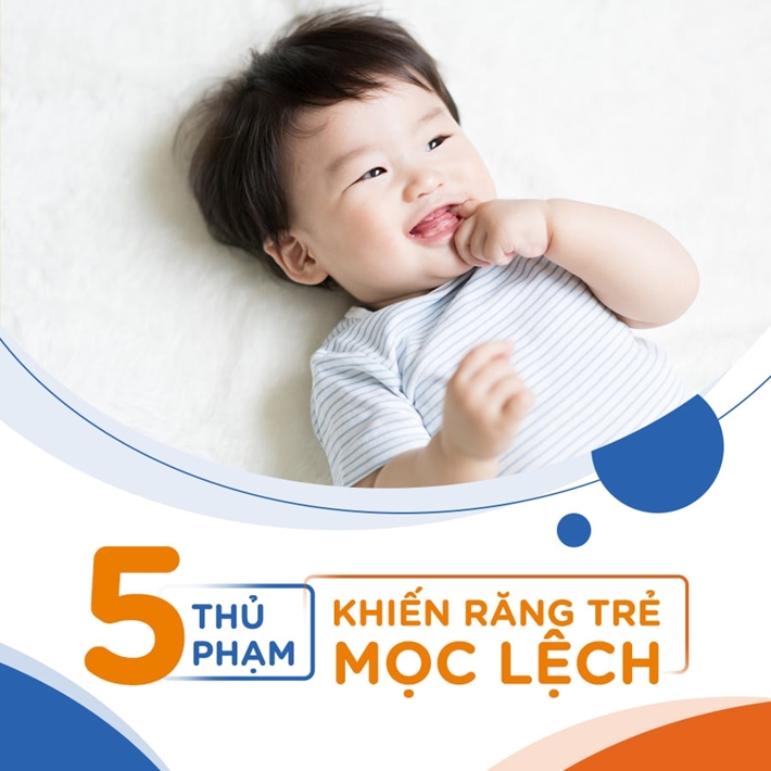 5 "Thủ Phạm" Khiến Răng Trẻ Mọc Lệch 