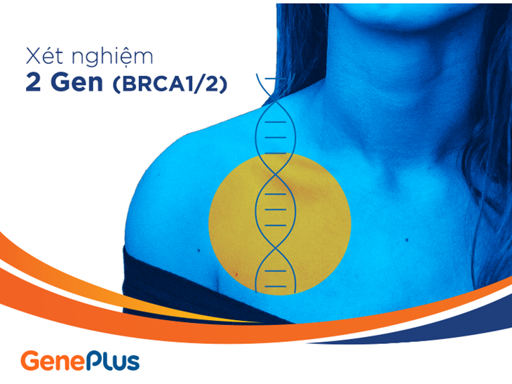 Xét Nghiệm GenePlus Tầm Soát Ung Thư Vú và Buồng Trứng (2 gen)