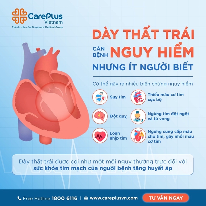 DÀY THẤT TRÁI - CĂN BỆNH NGUY HIỂM NHƯNG ÍT NGƯỜI BIẾT