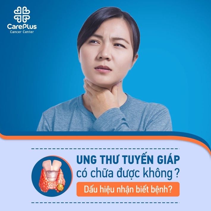 Ung thư tuyến giáp có chữa được không? Dấu hiệu nhận biết bệnh?