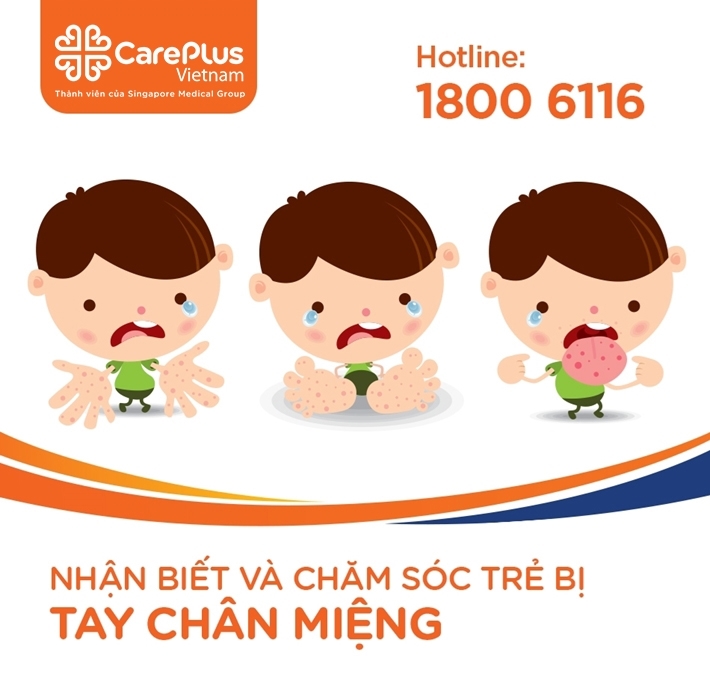 Mùa cao điểm của tay chân miệng đã quay lại!