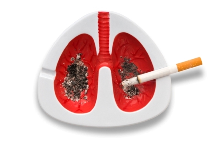 Lung cancer - symptoms and prevention