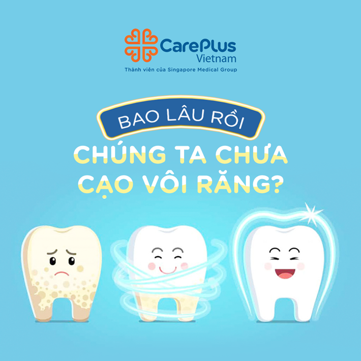 Bao lâu rồi chúng ta chưa cạo vôi răng?