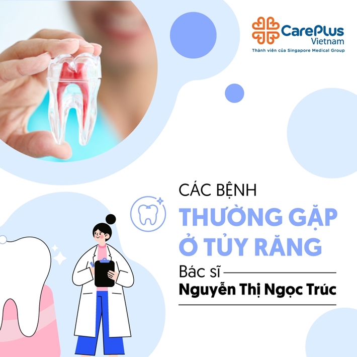 Các bệnh thường gặp ở tủy răng