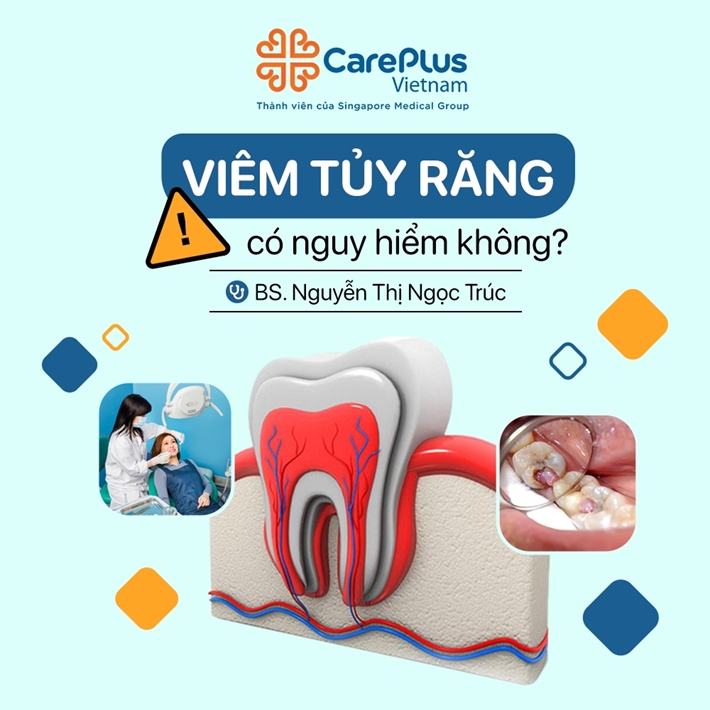 Viêm tủy răng có nguy hiểm không?