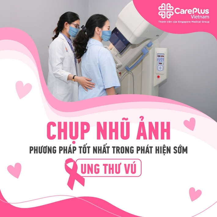 Chụp nhũ ảnh - Phương pháp tốt nhất trong phát hiện sớm ung thư vú