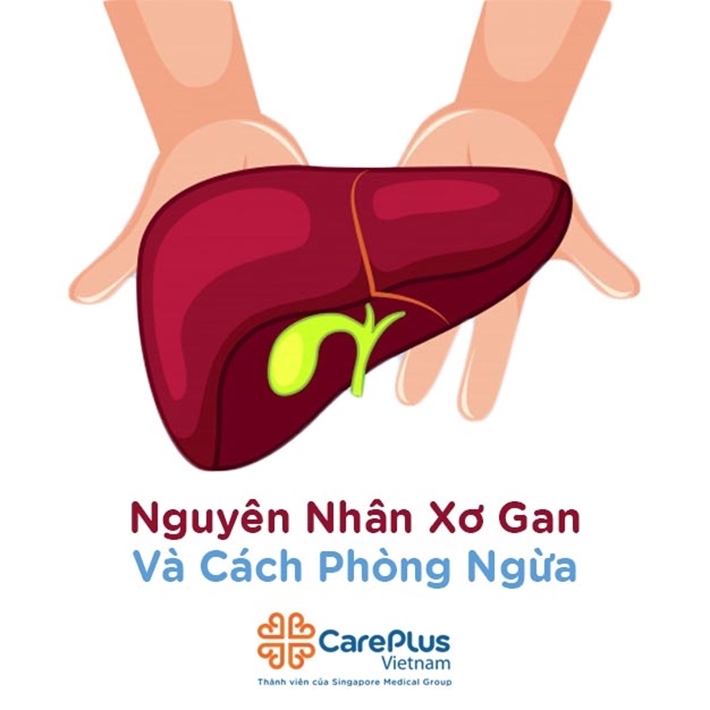 Nguyên nhân xơ gan và cách phòng ngừa?