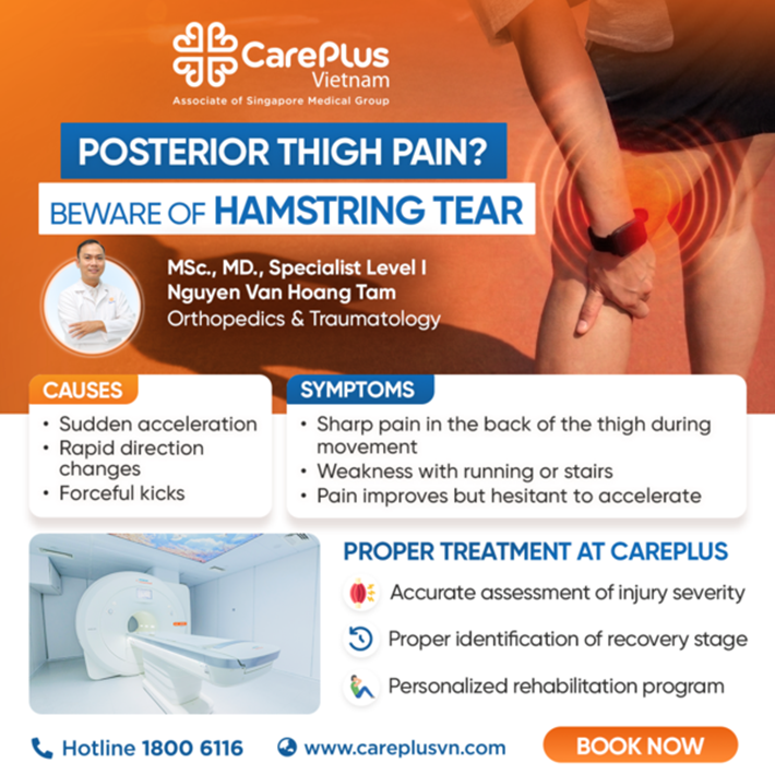 POSTERIOR THIGH PAIN? BEWARE OF A HAMSTRING TEAR 