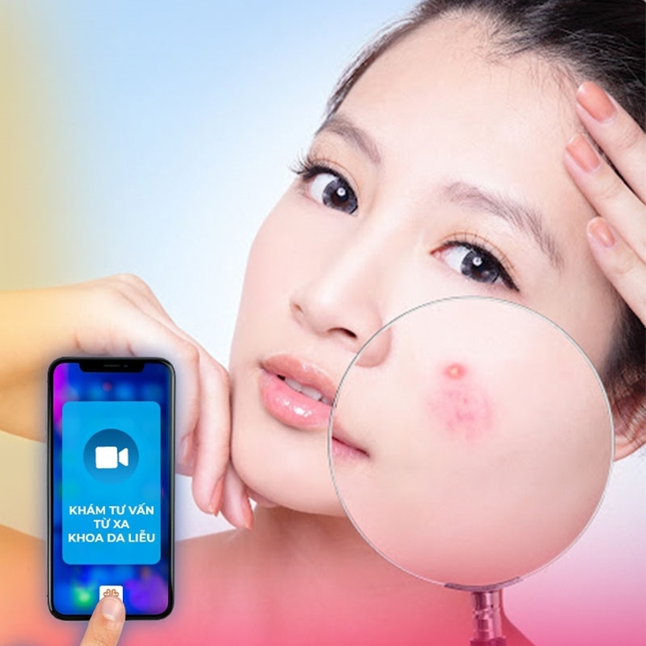 Khám bệnh Mụn trứng cá