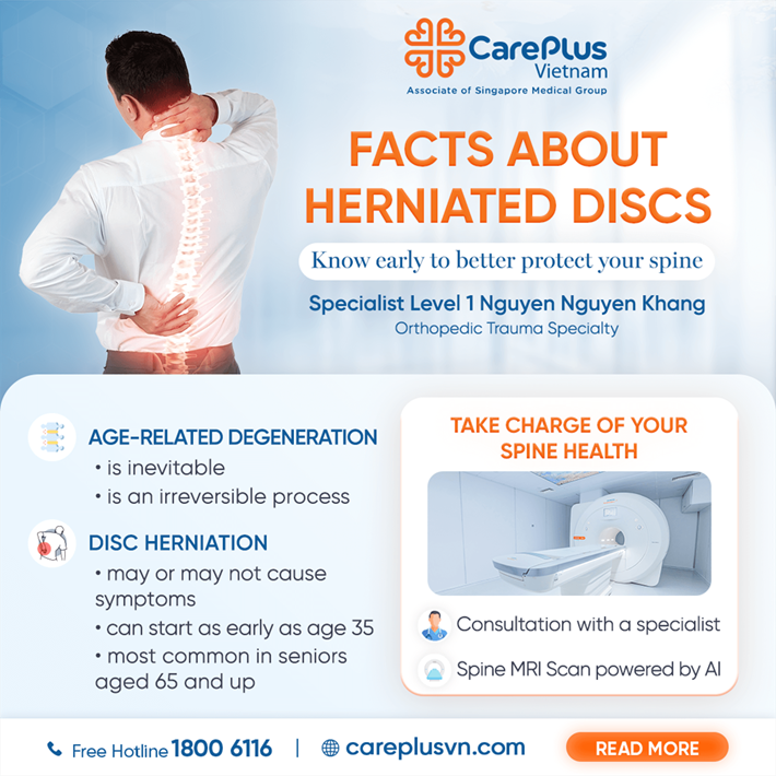 5 FACTS ABOUT HERNIATED DISCS – KNOW EARLY TO BETTER PROTECT YOUR SPINE 