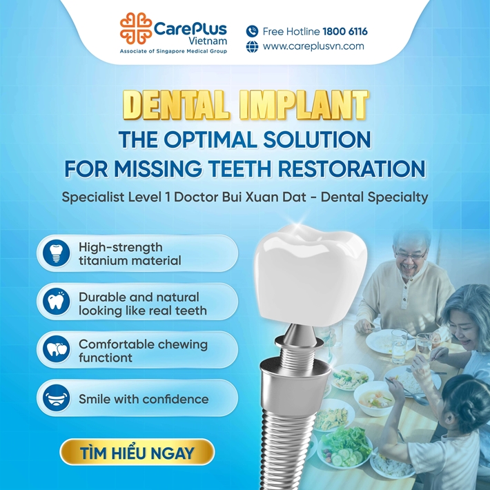 DENTAL IMPLANTS – THE OPTIMAL SOLUTION FOR MISSING TOOTH RESTORATION