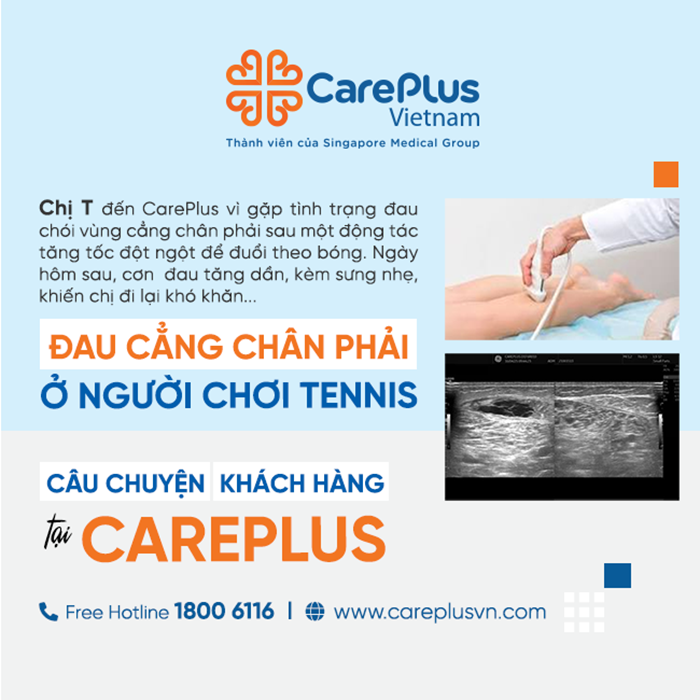 ĐAU CẲNG CHÂN PHẢI Ở NGƯỜI CHƠI TENNIS - CHẤN THƯƠNG ĐIỂN HÌNH CỦA BỘ MÔN THỂ THAO NÀY