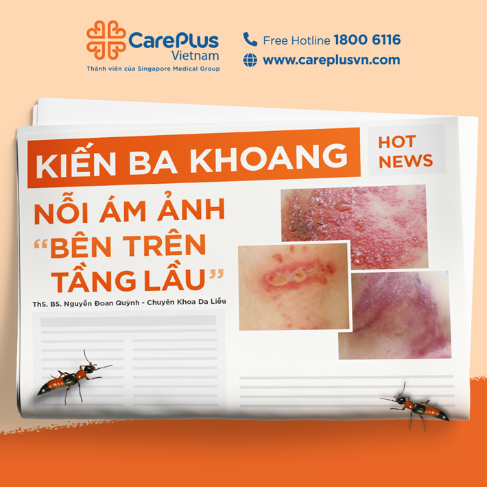 KIẾN BA KHOANG VÀO MÙA - NHẬN BIẾT & ĐỀ PHÒNG “VIÊM DA” 