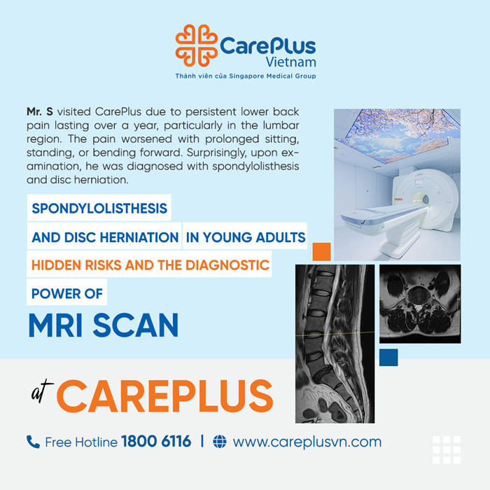 SPONDYLOLISTHESIS AND DISC HERNIATION IN YOUNG ADULTS – HIDDEN RISKS AND THE DIAGNOSTIC POWER OF MRI