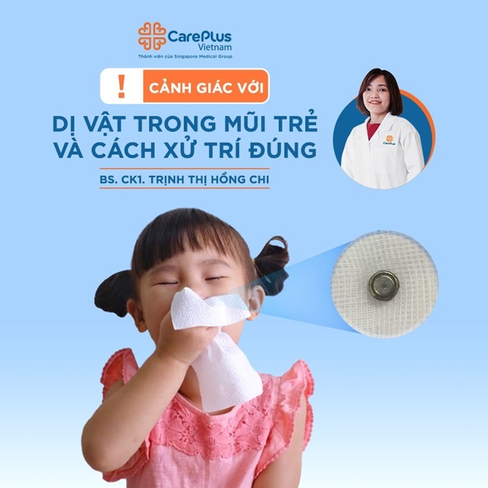 Cảnh giác với dị vật trong mũi trẻ & Cách xử trí đúng