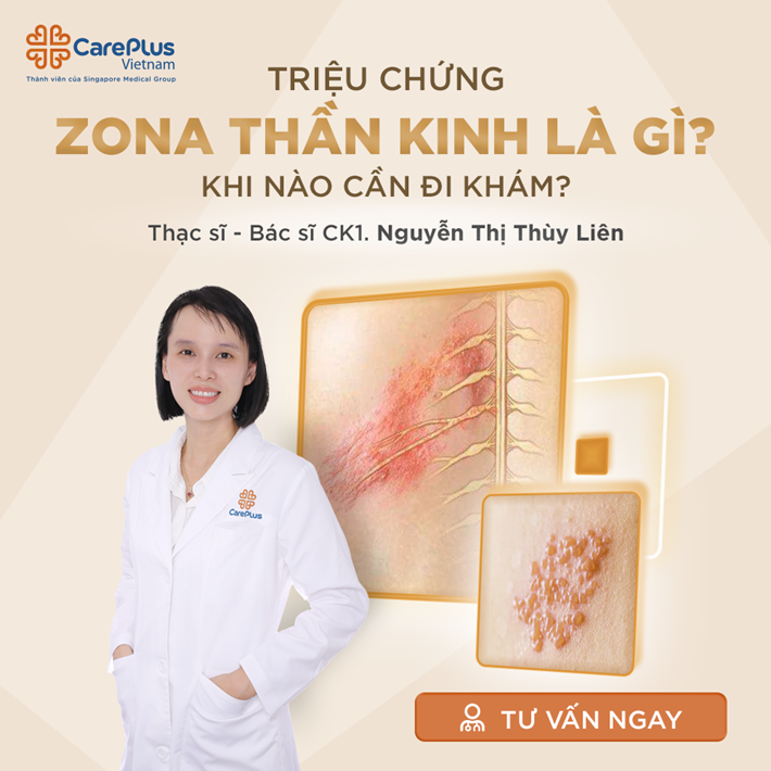 TẤT CẢ NHỮNG GÌ BẠN CẦN BIẾT VỀ BỆNH ZONA THẦN KINH (GIỜI LEO)
