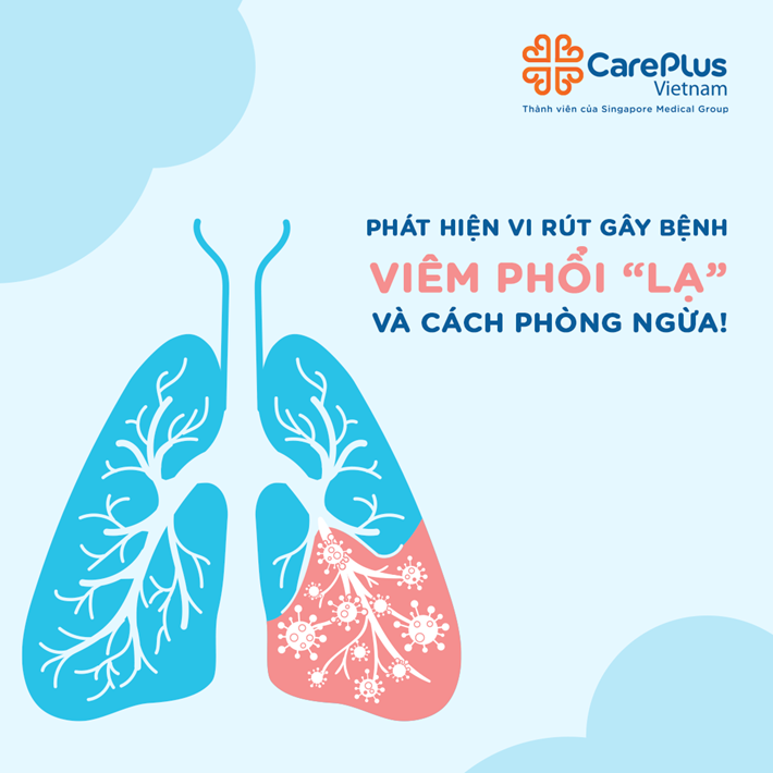 Cách phòng ngừa viêm phổi Virus Corona