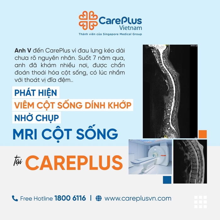 PHÁT HIỆN VIÊM CỘT SỐNG DÍNH KHỚP NHỜ MRI CỘT SỐNG CHÌA KHÓA GIÚP CHẨN ĐOÁN SỚM VÀ CHÍNH XÁC 
