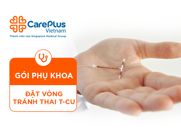 Đặt Vòng Tránh Thai T-Cu