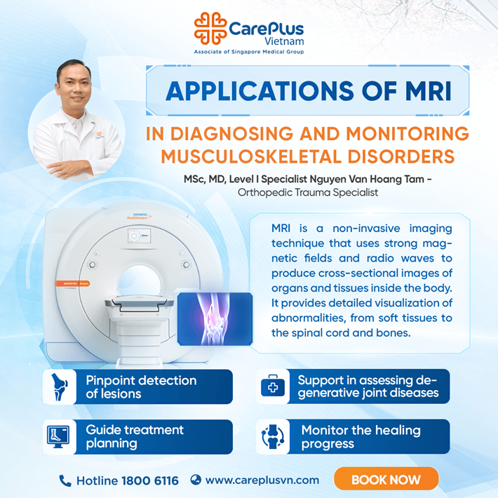 4 KEY APPLICATIONS OF MRI IN DIAGNOSING AND MONITORING MUSCULOSKELETAL DISORDERS 