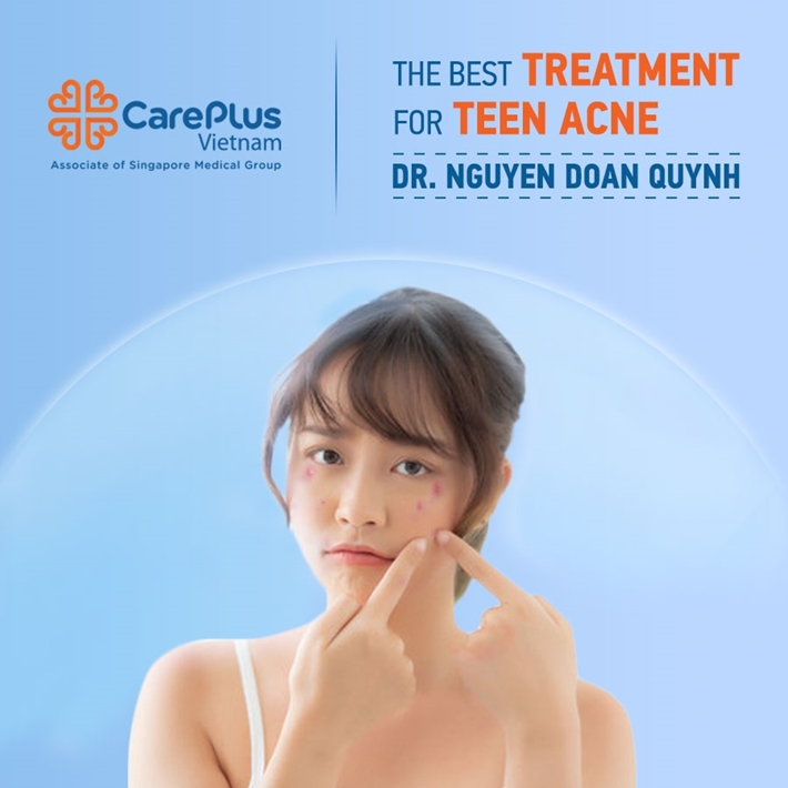 The best treatment for teen acne