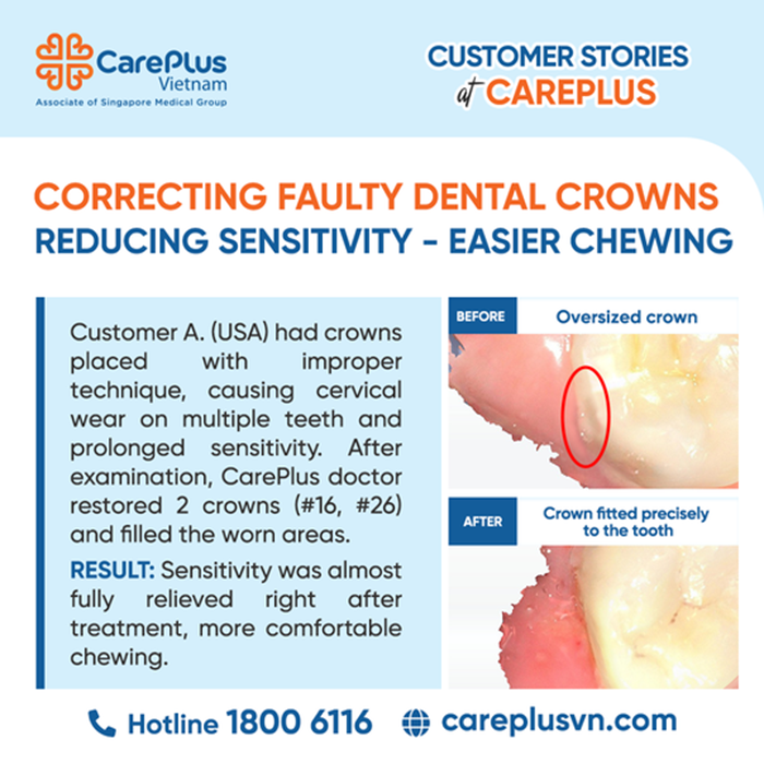 CORRECTING FAULTY DENTAL CROWNS - REDUCING SENSITIVITY & EASIER CHEWING 