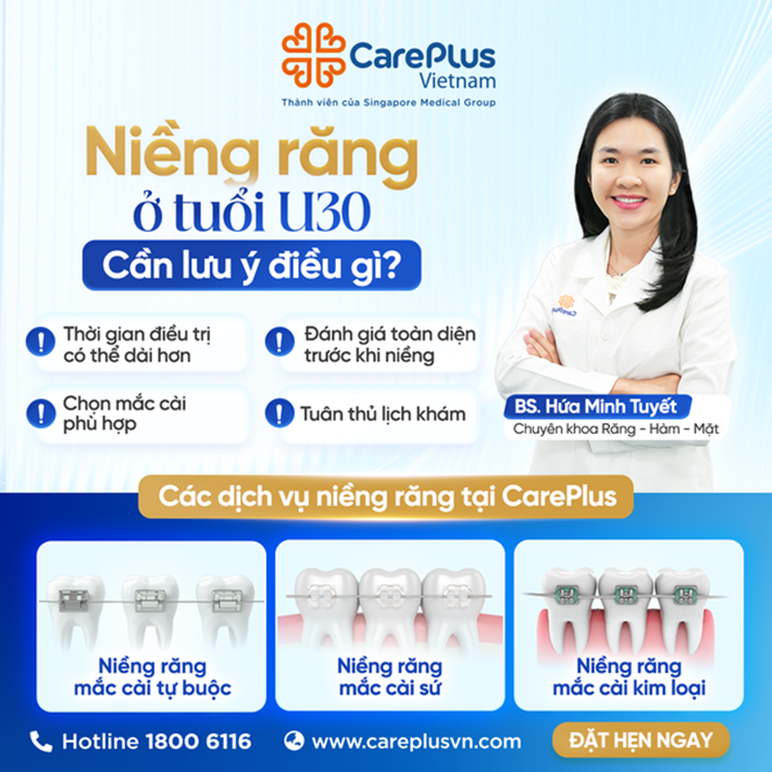 NIỀNG RĂNG Ở TUỔI U30 CẦN LƯU Ý ĐIỀU GÌ? 