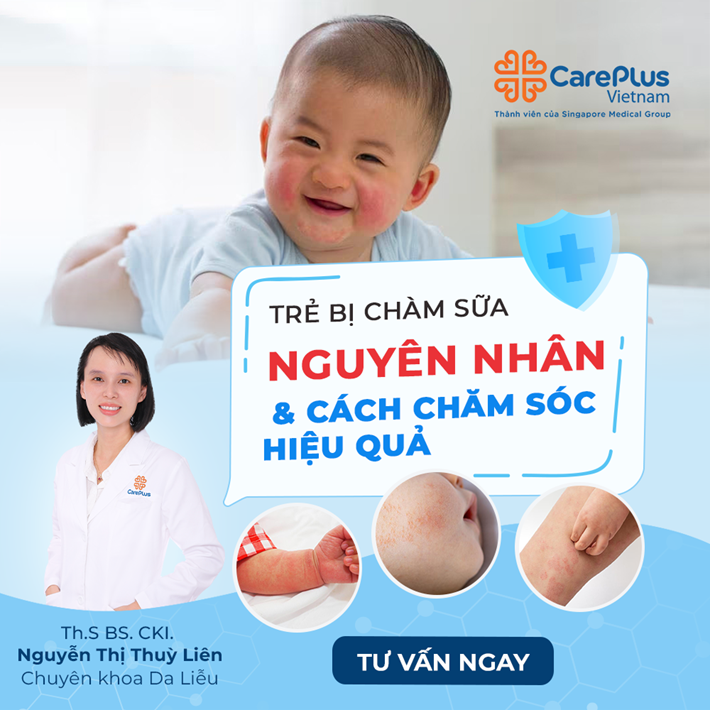 Trẻ Bị Chàm Sữa Nguyên Nhân Và Cách Chăm Sóc Hiệu Quả