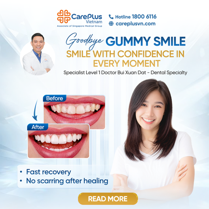GOODBYE GUMMY SMILE - SMILE WITH CONFIDENCE IN EVERY MOMENT 