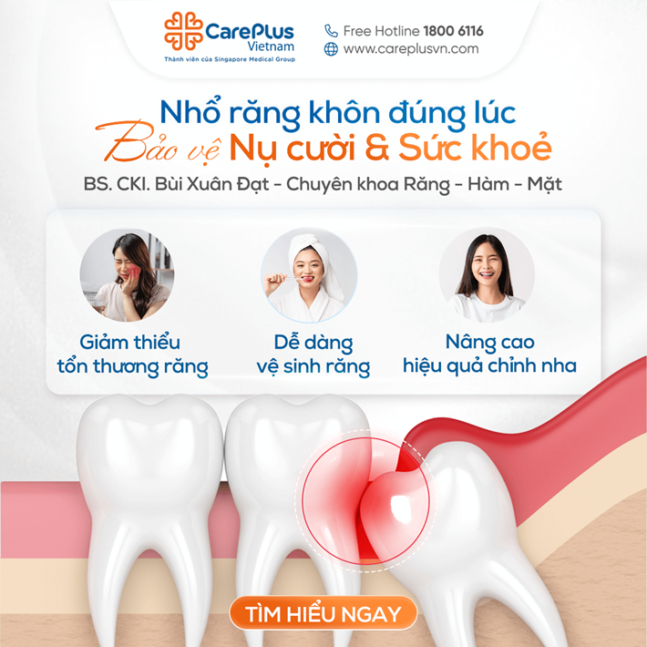 NHỔ RĂNG KHÔN ĐÚNG LÚC - BẢO VỆ NỤ CƯỜI VÀ SỨC KHỎE TỪ HÔM NAY 
