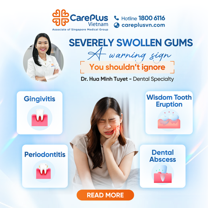 SWOLLEN GUMS: A WARNING SIGN YOU SHOULDN'T IGNORE 
