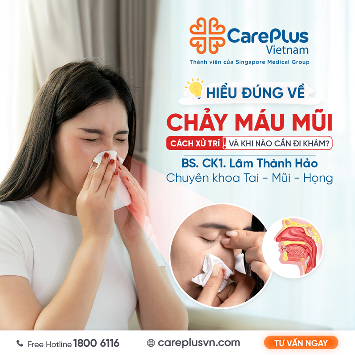 HIỂU ĐÚNG VỀ CHẢY MÁU MŨI – CÁCH XỬ TRÍ VÀ KHI NÀO CẦN ĐI KHÁM?