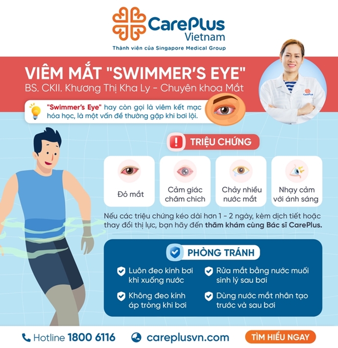 VIÊM MẮT "SWIMMER’S EYE" - LÀM SAO ĐỂ PHÒNG TRÁNH KHI ĐI BƠI MÙA HÈ? 