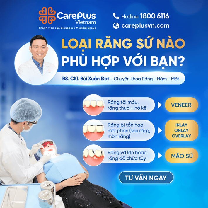 LOẠI RĂNG SỨ NÀO PHÙ HỢP VỚI BẠN? 