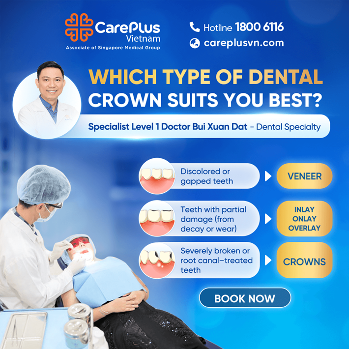 WHICH TYPE OF DENTAL CROWN SUITS YOU BEST? 
