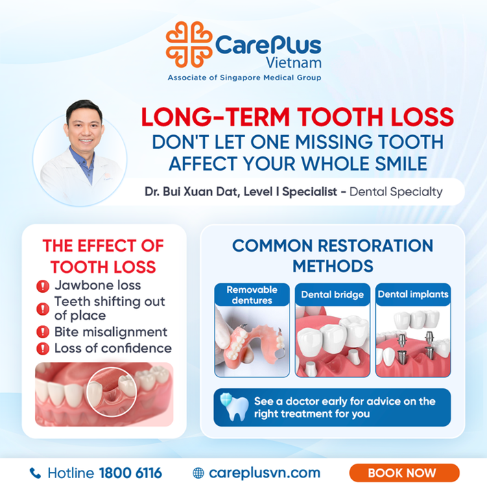 LONG-TERM TOOTH LOSS DON'T LET ONE MISSING TOOTH AFFECT YOUR WHOLE SMILE 