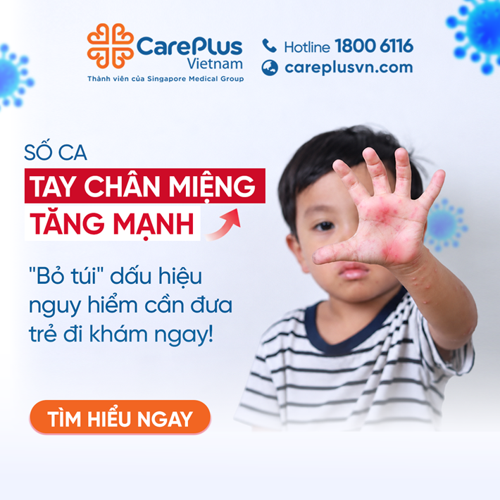 🚨 BA MẸ ĐỪNG CHỦ QUAN! BỆNH TAY CHÂN MIỆNG ĐANG TĂNG MẠNH! 