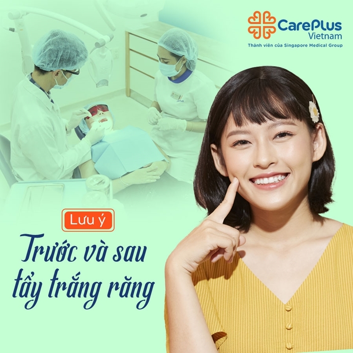 Lưu ý trước và sau khi tẩy trắng răng