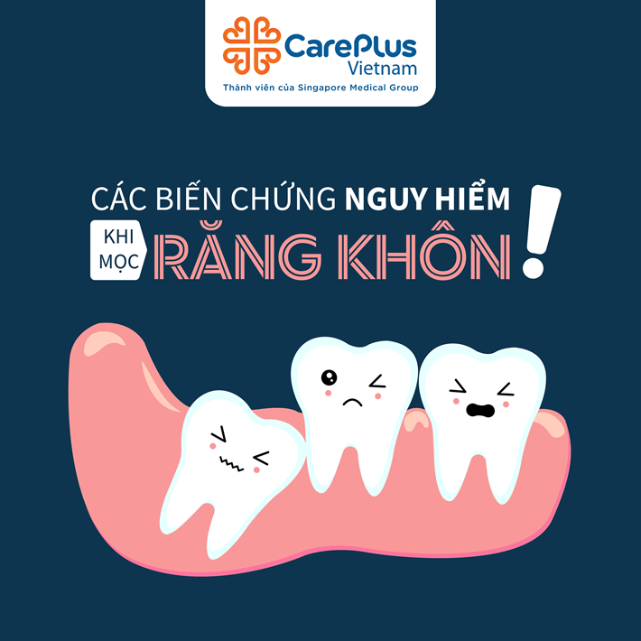 Các biến chứng nguy hiểm khi mọc răng khôn