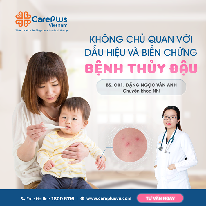 KHÔNG CHỦ QUAN VỚI DẤU HIỆU VÀ BIẾN CHỨNG CỦA BỆNH THỦY ĐẬU 