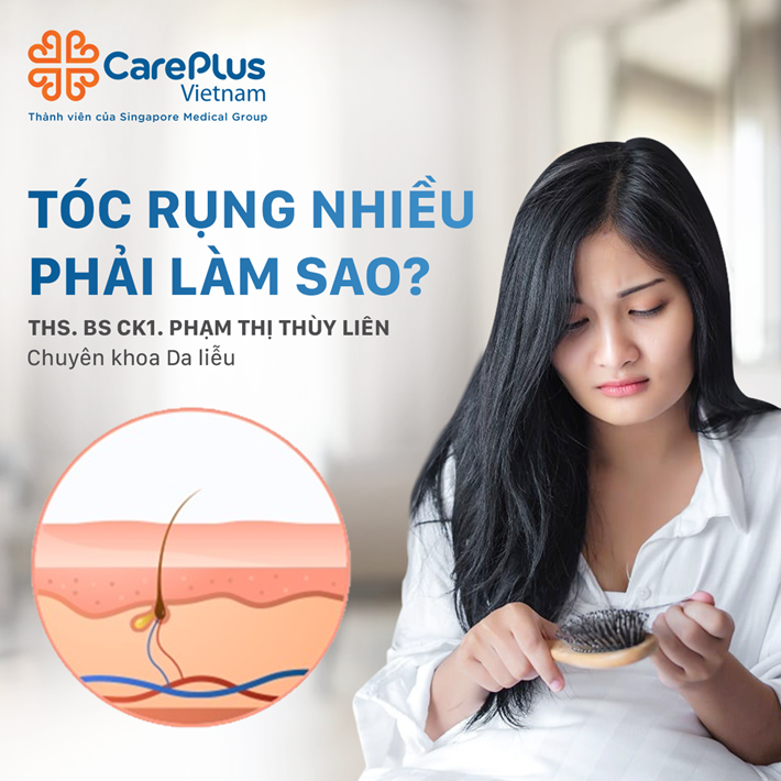 NÊN LÀM GÌ ĐỂ CHẤM DỨT “NỖI ÁM ẢNH” MANG TÊN RỤNG TÓC?