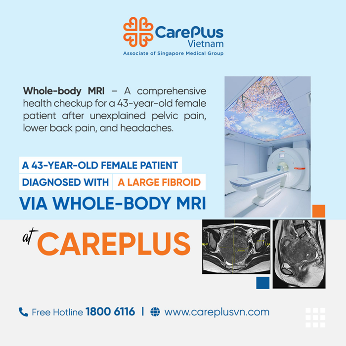CUSTOMER STORY: 43-YEAR-OLD WOMAN DISCOVERS LARGE FIBROID THROUGH WHOLE-BODY MRI