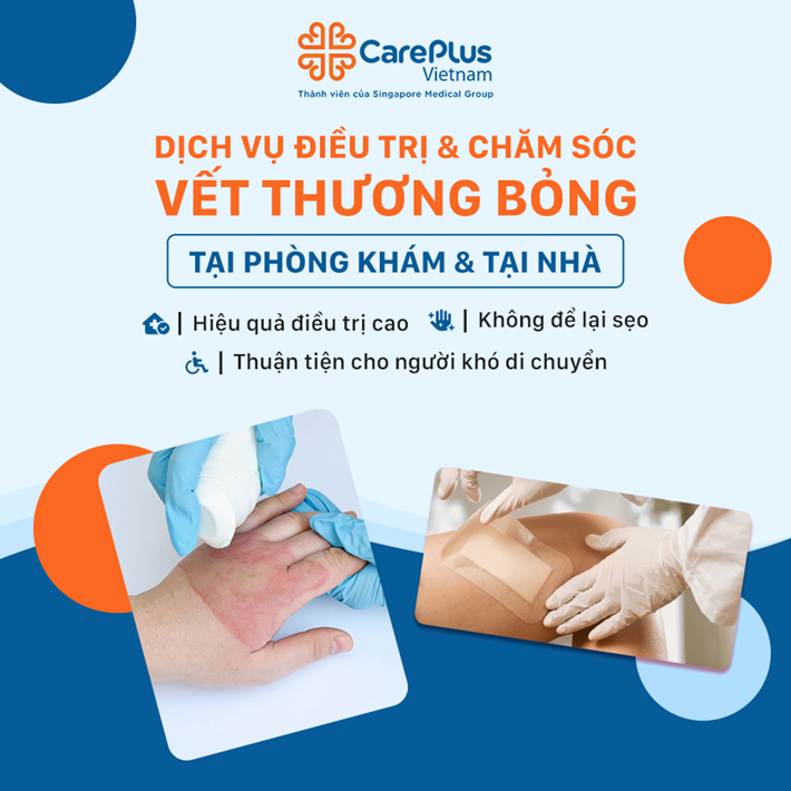 Chăm sóc vết thương bỏng an toàn và không để lại sẹo cùng CarePlus