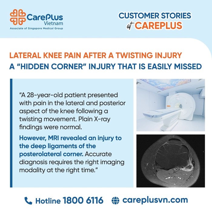 LATERAL KNEE PAIN AFTER A TWISTING INJURY –   A “HIDDEN CORNER” INJURY THAT IS EASILY MISSED 