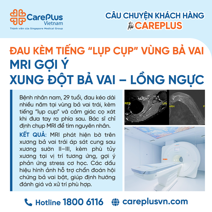 ĐAU KÈM TIẾNG “LỤP CỤP” VÙNG BẢ VAI – GIÁ TRỊ CỦA MRI TRONG PHÁT HIỆN XUNG ĐỘT BẢ VAI – LỒNG NGỰC 