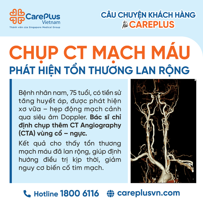 GIÁ TRỊ CỦA CTA TRONG ĐÁNH GIÁ TOÀN DIỆN BỆNH LÝ MẠCH MÁU SAU TẦM SOÁT BẰNG SIÊU ÂM 