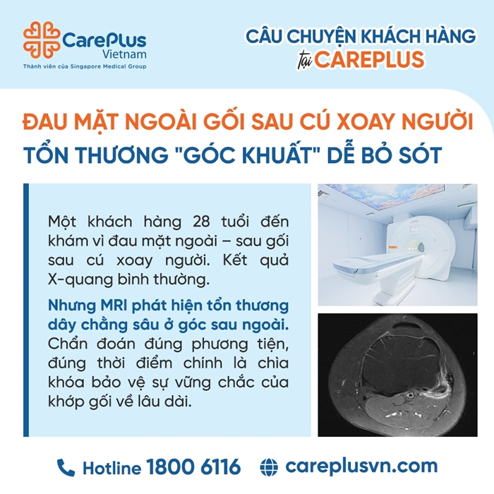 ĐAU MẶT NGOÀI GỐI SAU CÚ XOAY NGƯỜI – TỔN THƯƠNG "GÓC KHUẤT" DỄ BỎ SÓT