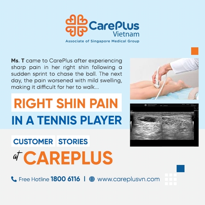 RIGHT SHIN PAIN IN A TENNIS PLAYER