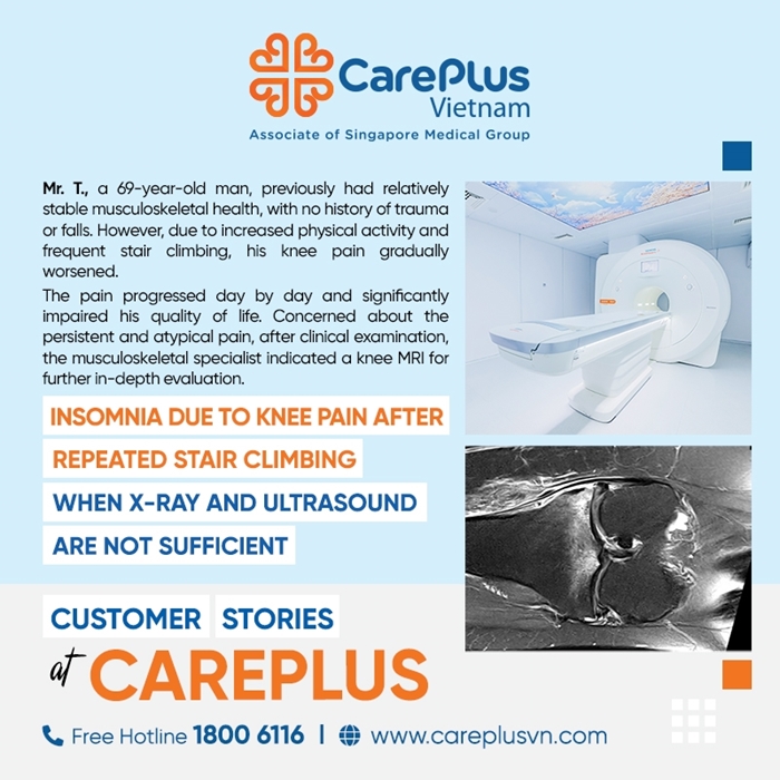 INSOMNIA DUE TO KNEE PAIN AFTER REPEATED STAIR CLIMBING – WHEN X-RAY AND ULTRASOUND ARE NOT SUFFICIENT 