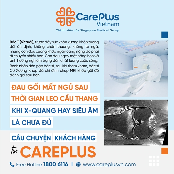 ĐAU GỐI MẤT NGỦ SAU THỜI GIAN LEO CẦU THANG – KHI X-QUANG HAY SIÊU ÂM LÀ CHƯA ĐỦ